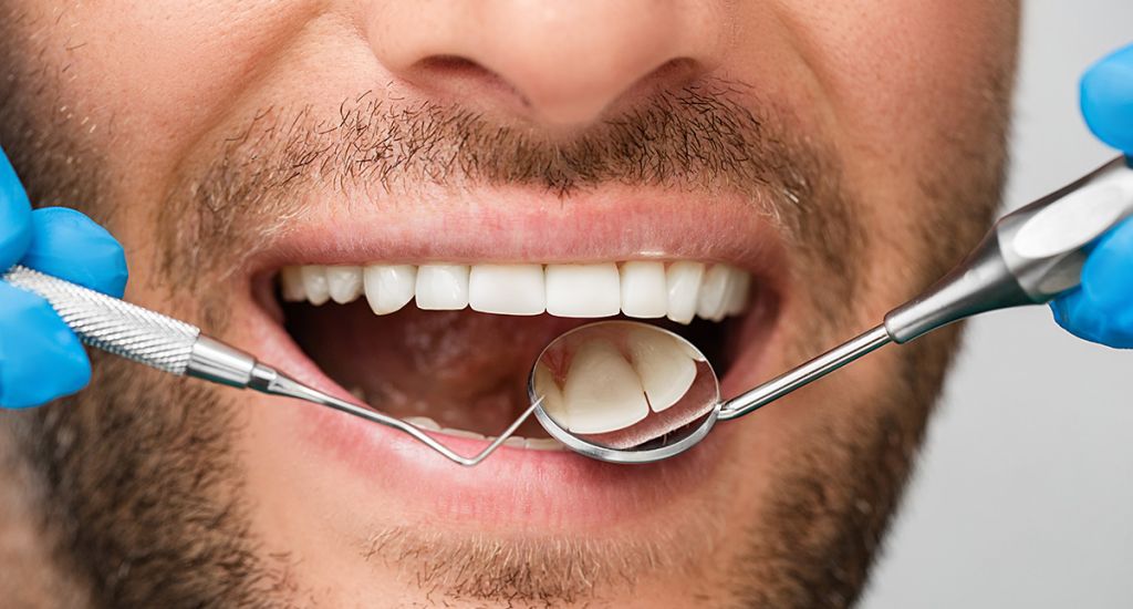 Dental Exams and Cleaning - SoBro Dental - Broad Ripple / SoBro Dentistry - Indianapolis, Indiana