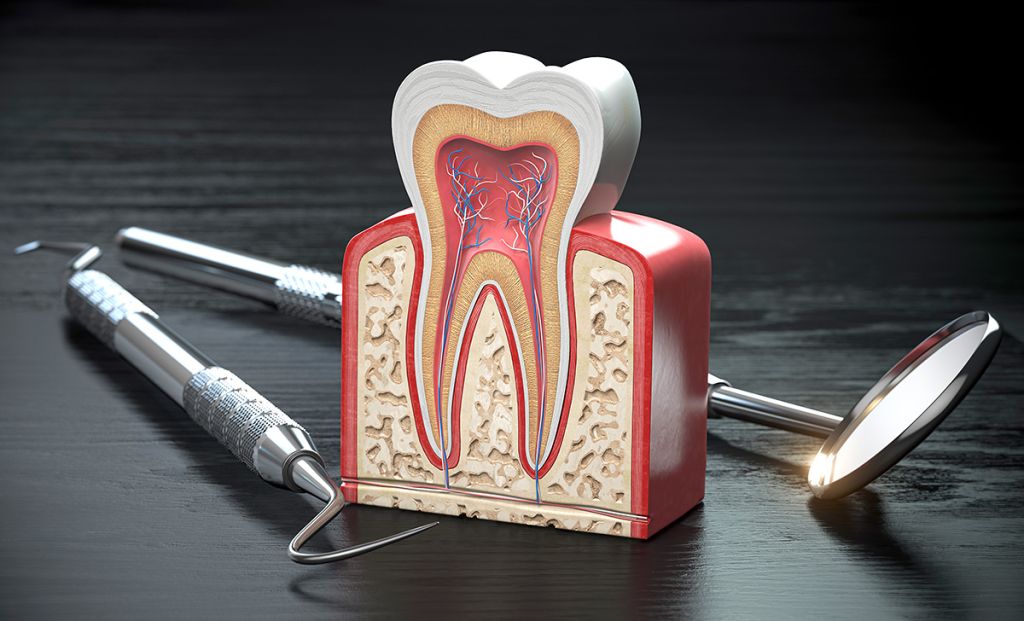 Dental Root Canal - SoBro Dental - Broad Ripple / SoBro Dentistry - Indianapolis, Indiana