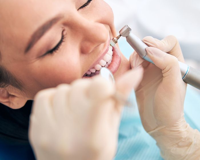 Signs You Need A Dental Cleaning - SoBro Dental Blog - Health Tips and Resources From Indianapolis Dentist