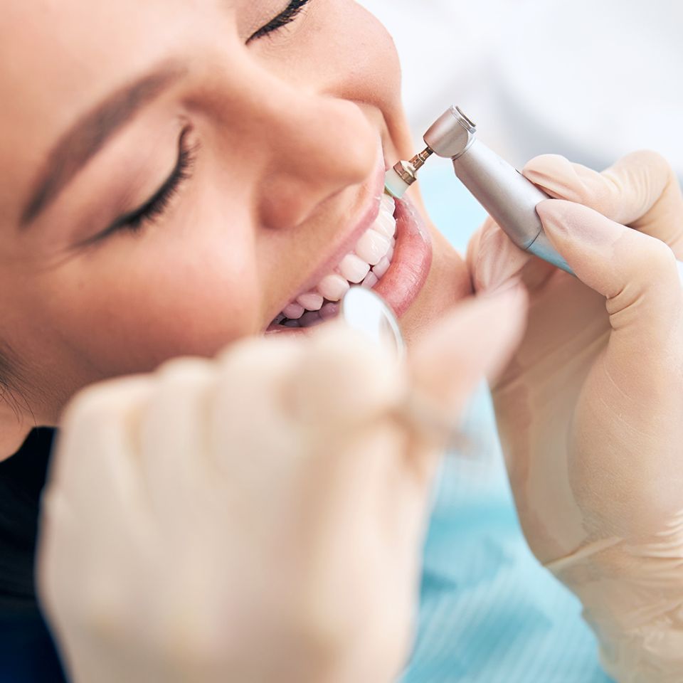 Signs You Need A Dental Cleaning - SoBro Dental Blog - Health Tips and Resources From Indianapolis Dentist