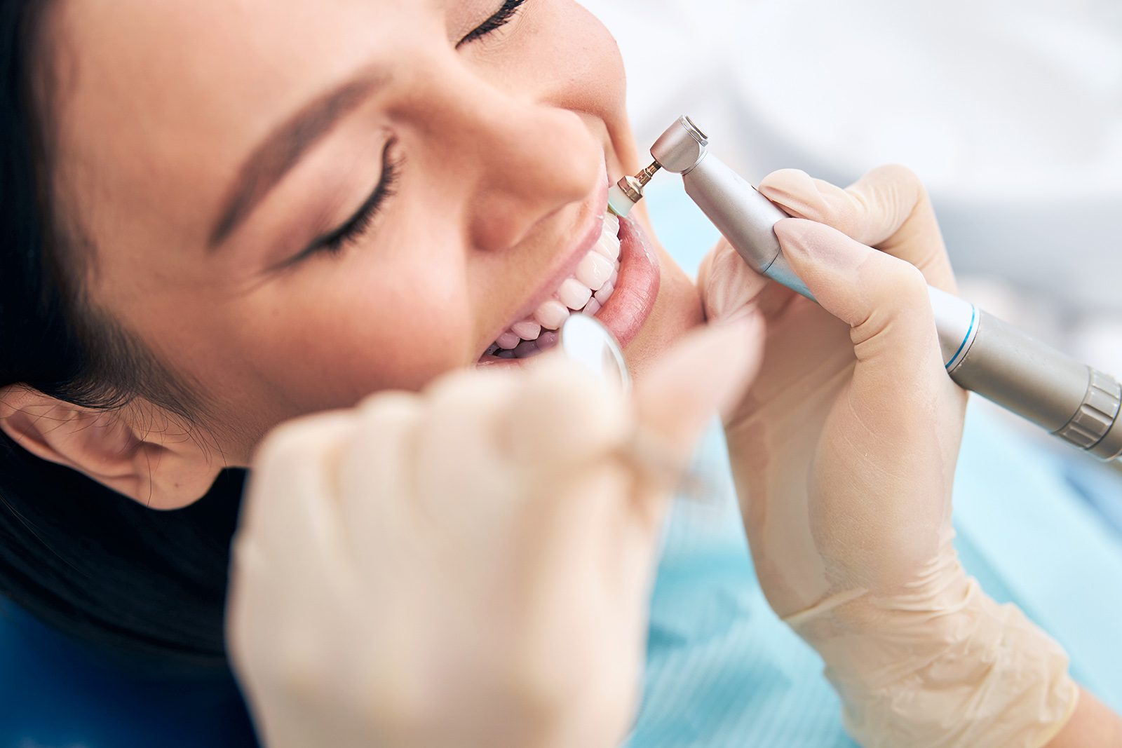 Signs You Need A Dental Cleaning - SoBro Dental Blog - Health Tips and Resources From Indianapolis Dentist