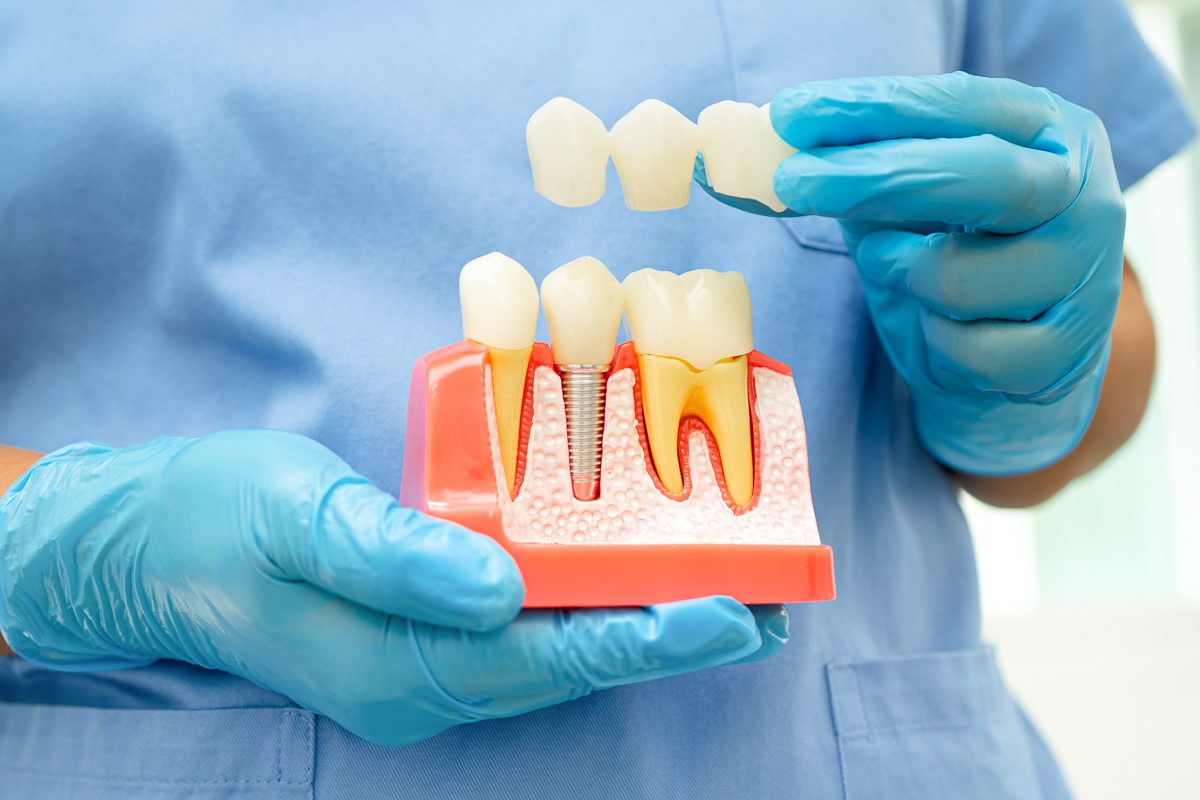 Causes And Treatment Options For Sensitive Teeth - Indianapolis, Broad Ripple & Meridan-Kessler, Indianapolis Dentist - SoBro Blog - Dental Health Tips & Resources
